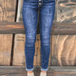 High Rise Button Fly Skinny Jean